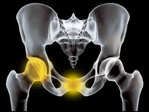 Melbourne Course: The Complete Hip